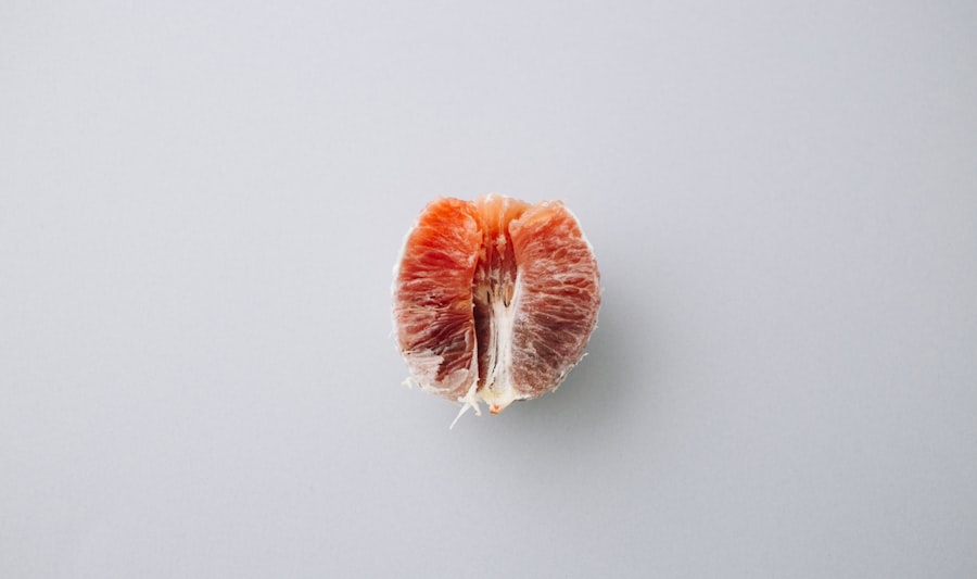 Diabetes and Kidney Disease