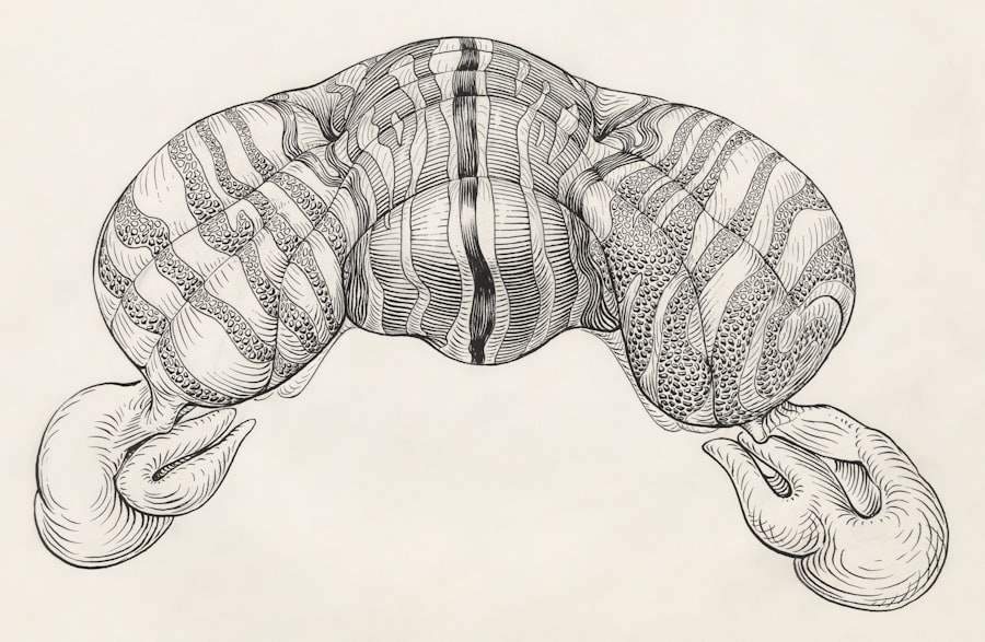 Artificial Pancreas Systems