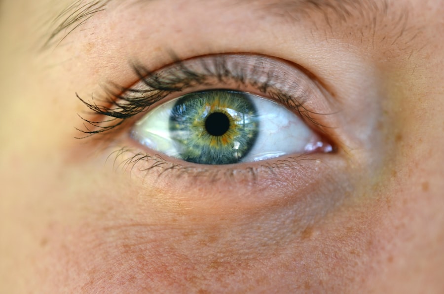 Photo Diabetes and Eye Health