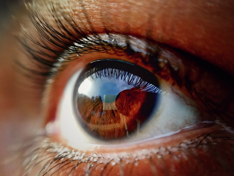 Photo Diabetic Eye Disease